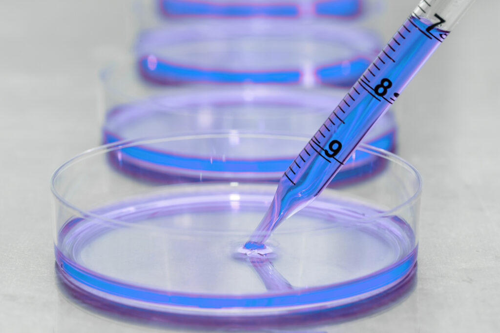 Bild Preparing cell culture